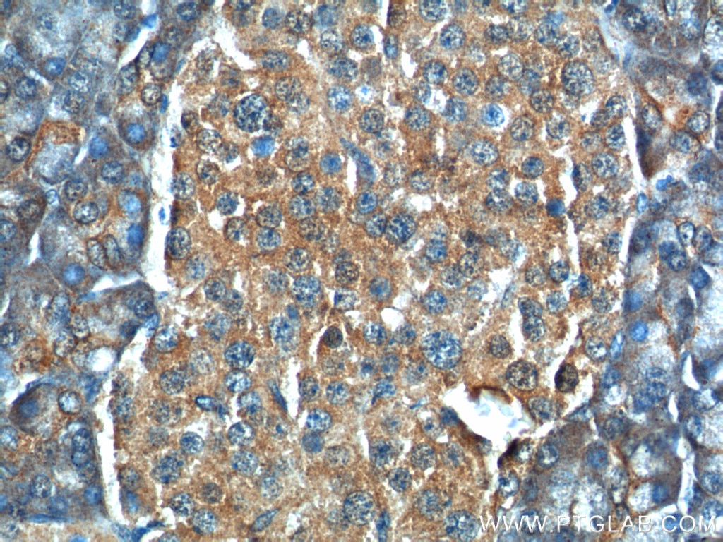 Immunohistochemistry (IHC) staining of human pancreas tissue using C11orf80 Polyclonal antibody (25957-1-AP)