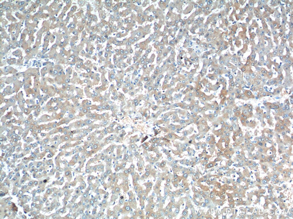 IHC staining of human liver using 25957-1-AP