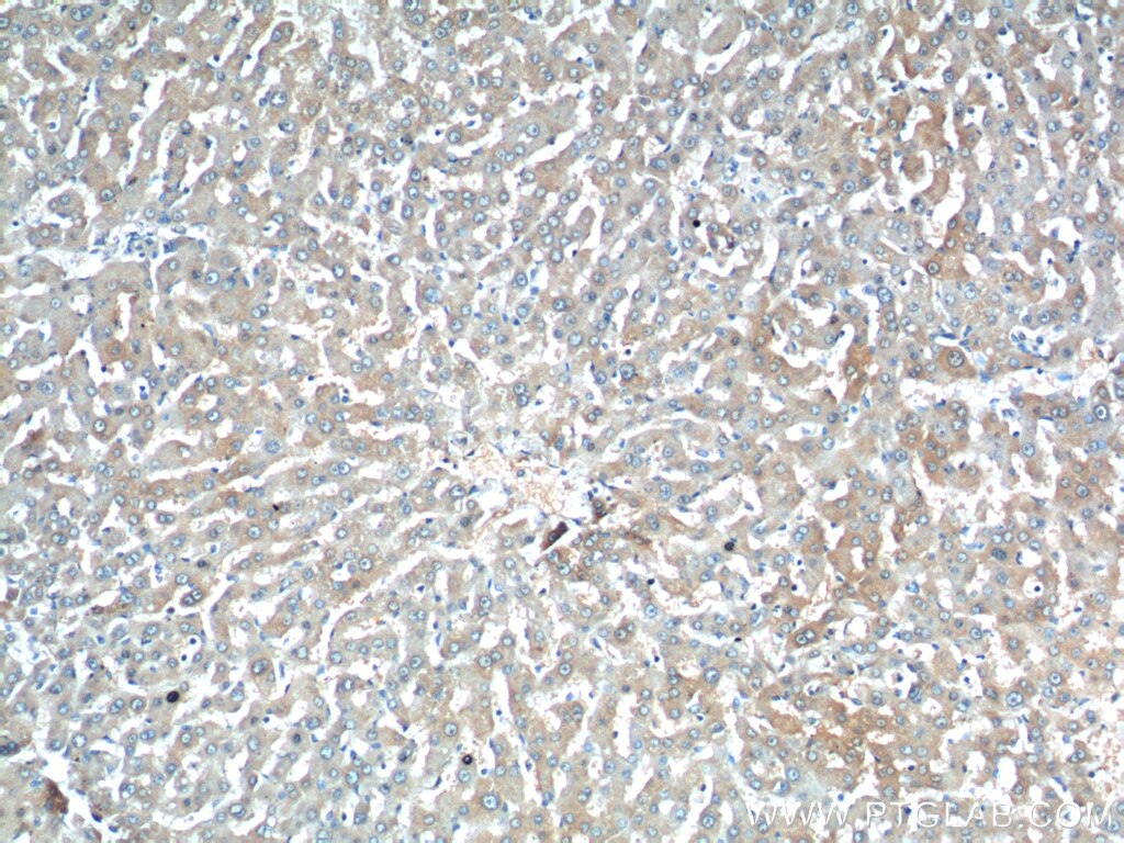 Immunohistochemistry (IHC) staining of human liver tissue using C11orf80 Polyclonal antibody (25957-1-AP)