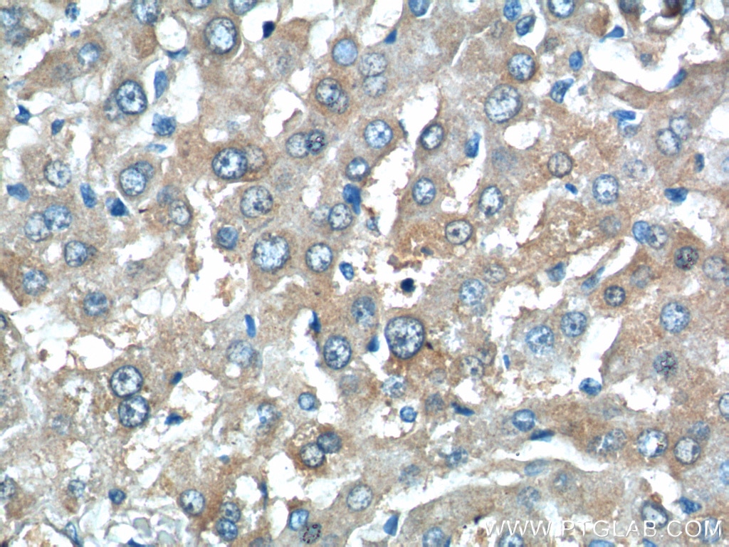 Immunohistochemistry (IHC) staining of human liver tissue using C11orf80 Polyclonal antibody (25957-1-AP)