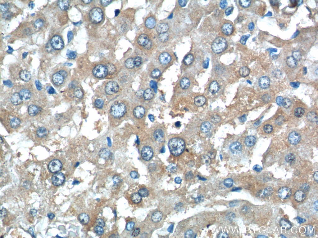 IHC staining of human liver using 25957-1-AP