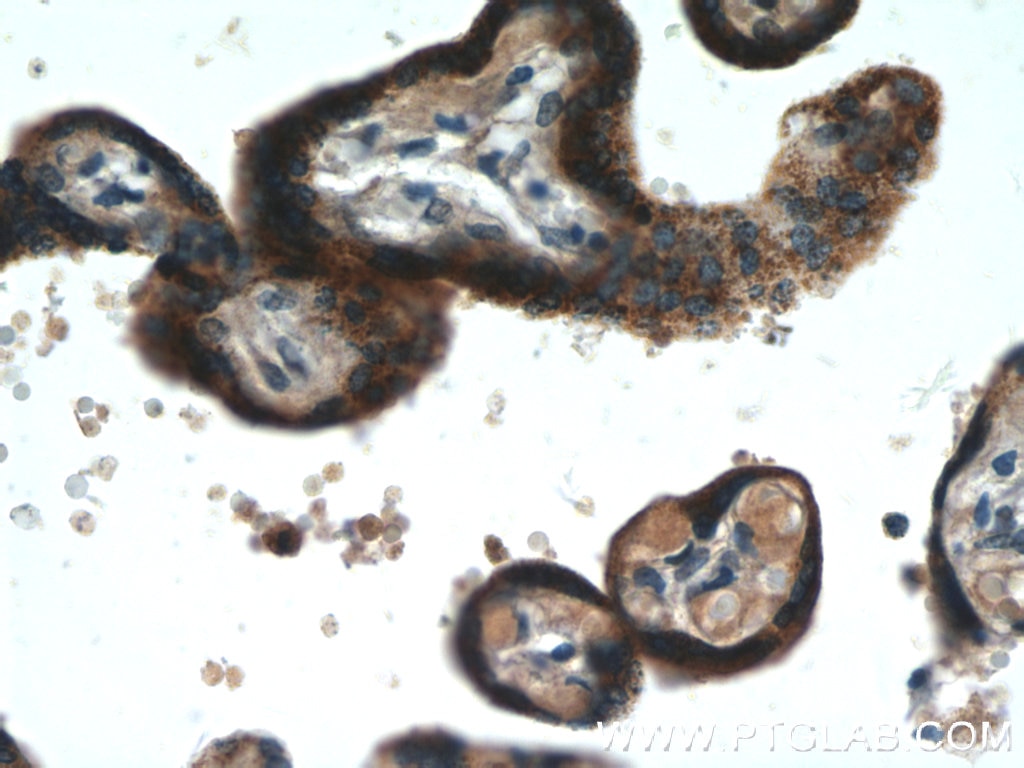 IHC staining of human placenta using 25651-1-AP