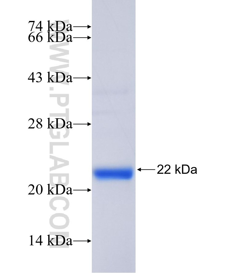 C11orf84 fusion protein Ag36080 SDS-PAGE C11orf84 fusion protein Ag36080 SDS-PAGE
