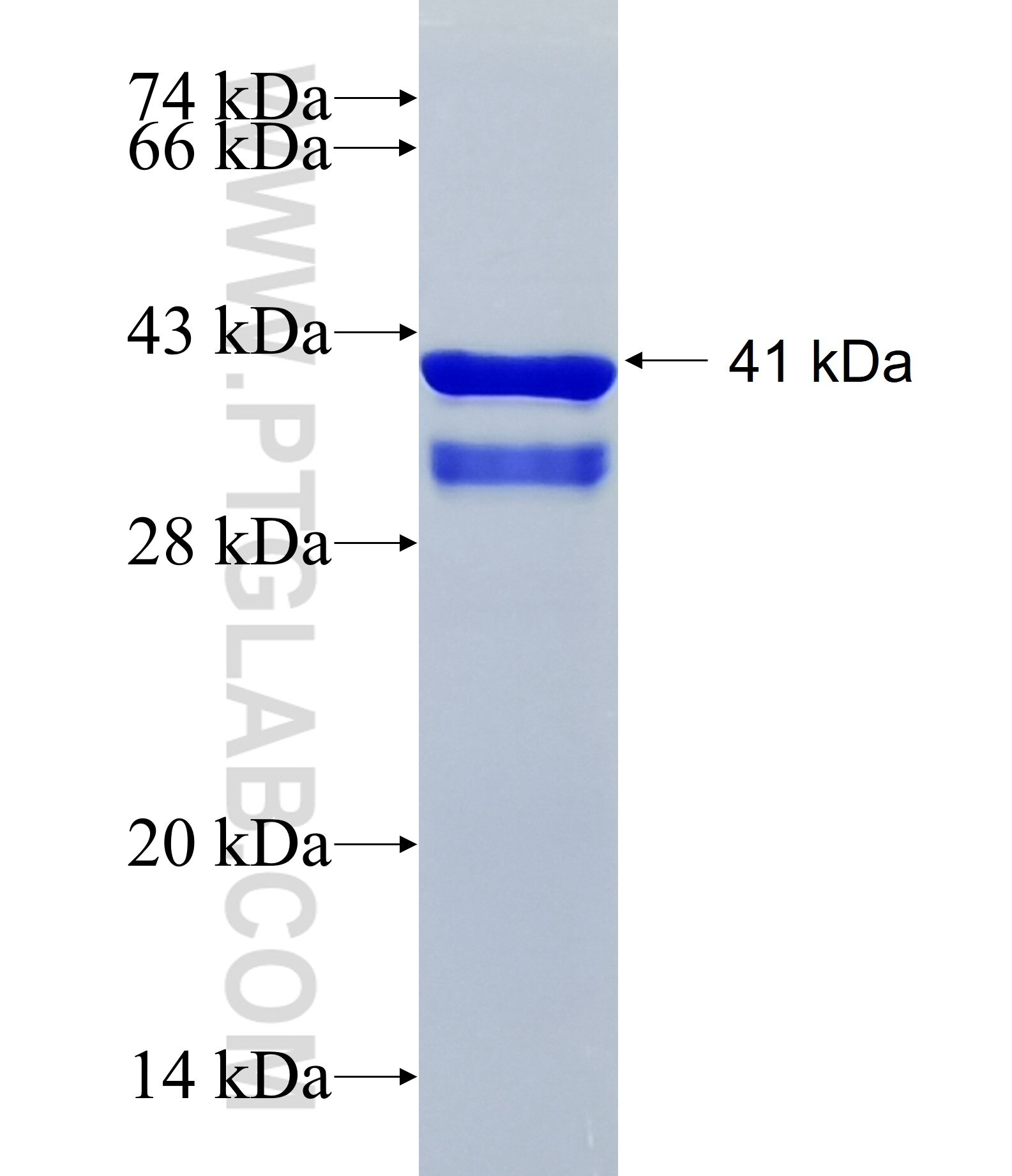 C11orf98 fusion protein Ag36283 SDS-PAGE