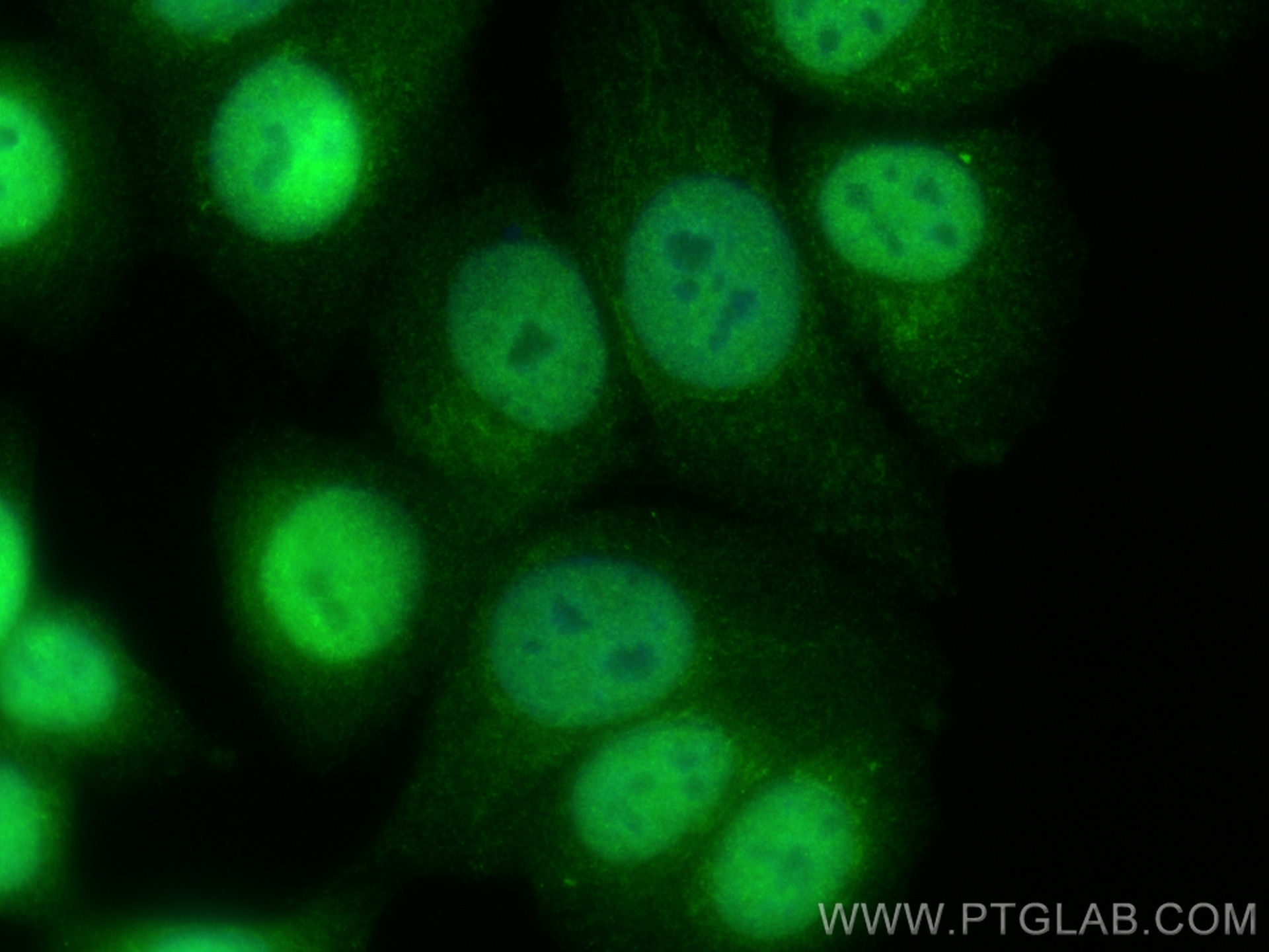Immunofluorescence (IF) / fluorescent staining of MCF-7 cells using ASUN Polyclonal antibody (19892-1-AP)