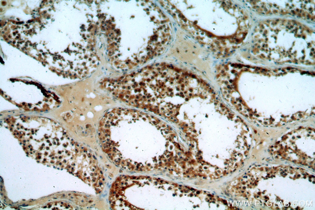 Immunohistochemistry (IHC) staining of human testis tissue using ASUN Polyclonal antibody (19892-1-AP)