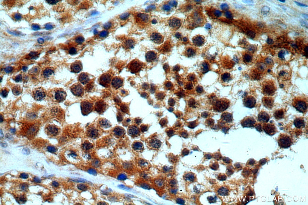 IHC staining of human testis using 19892-1-AP