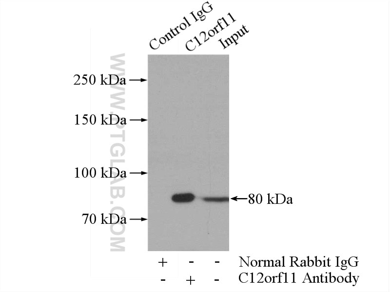 Immunoprecipitation (IP) experiment of MCF-7 cells using ASUN Polyclonal antibody (19892-1-AP)