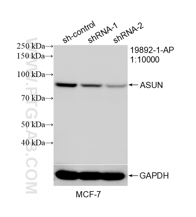 WB result of ASUN antibody (19892-1-AP; 1:10000; incubated at room temperature for 1.5 hours) with sh-Control and sh-ASUN transfected MCF-7 cells. Western Blot (WB) analysis of MCF-7 cells using ASUN Polyclonal antibody (19892-1-AP)