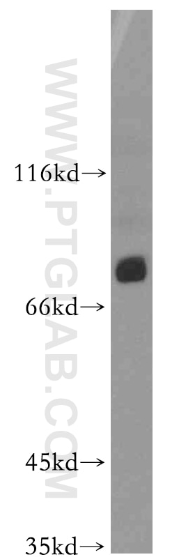 Western Blot (WB) analysis of MCF-7 cells using ASUN Polyclonal antibody (19892-1-AP)