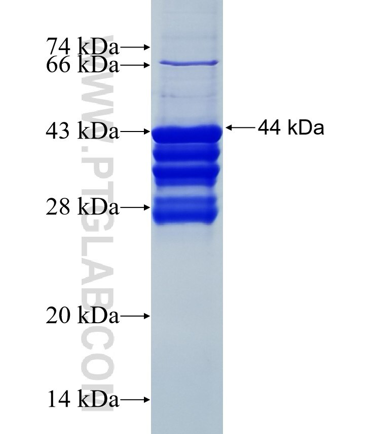C12orf24 fusion protein Ag27885 SDS-PAGE C12orf24 fusion protein Ag27885 SDS-PAGE