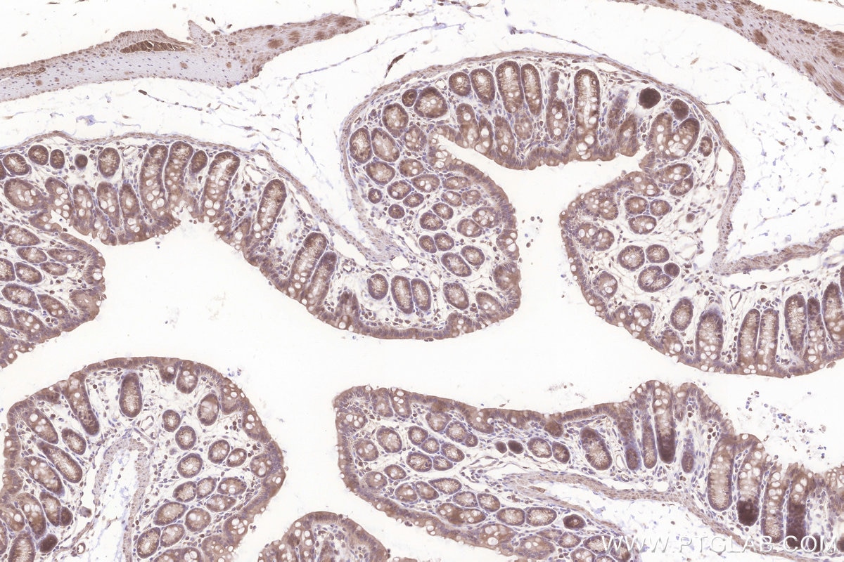 Immunohistochemistry (IHC) staining of mouse colon tissue using C12orf29 Polyclonal antibody (31647-1-AP)