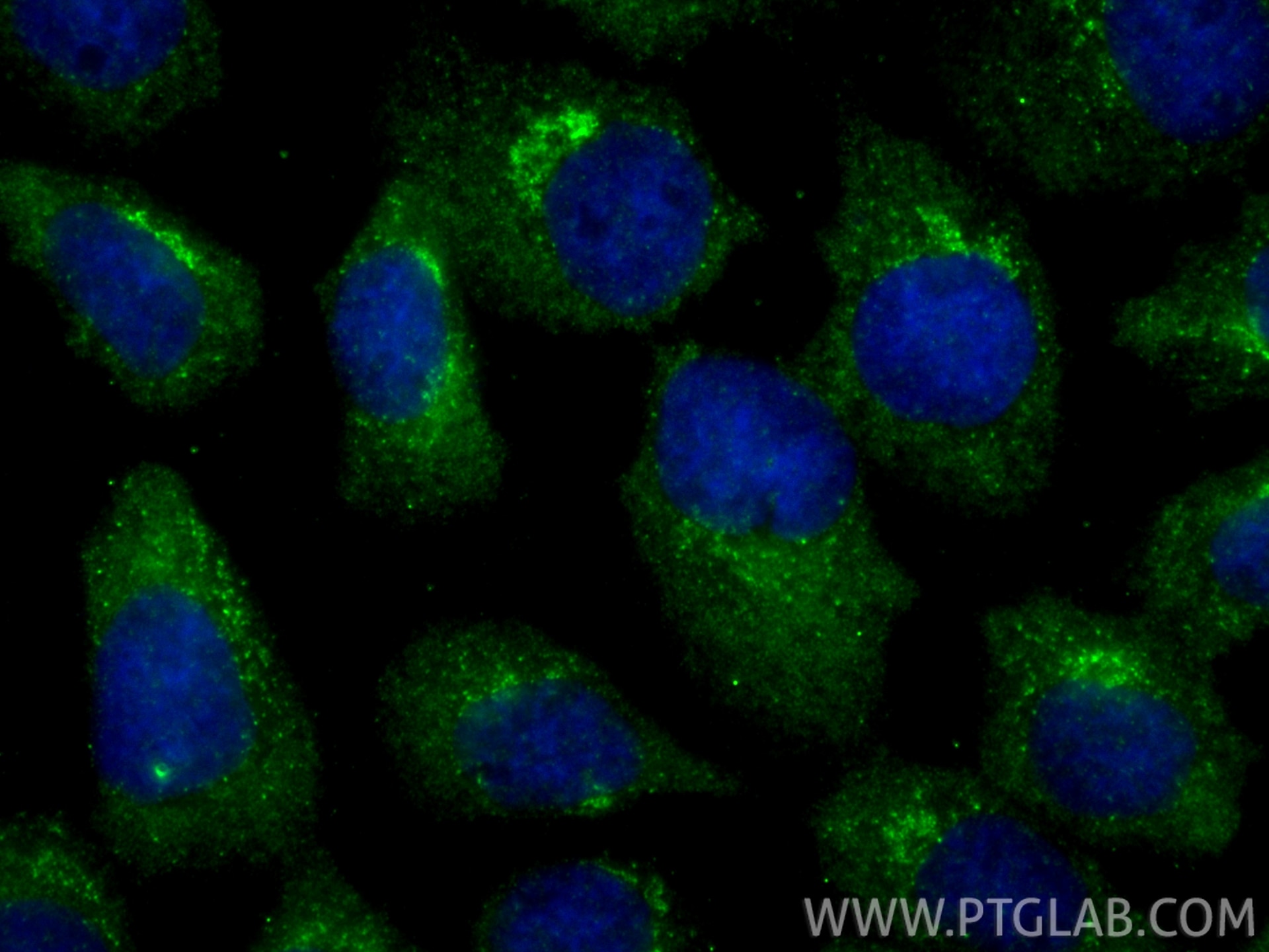 Immunofluorescence (IF) / fluorescent staining of A431 cells using C12orf30 Polyclonal antibody (31748-1-AP)