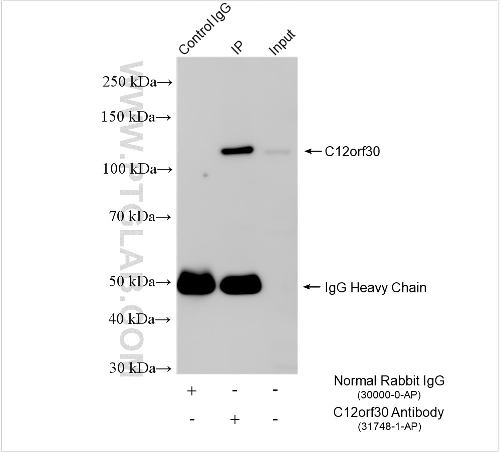 Immunoprecipitation (IP) experiment of mouse ovary tissue using C12orf30 Polyclonal antibody (31748-1-AP)