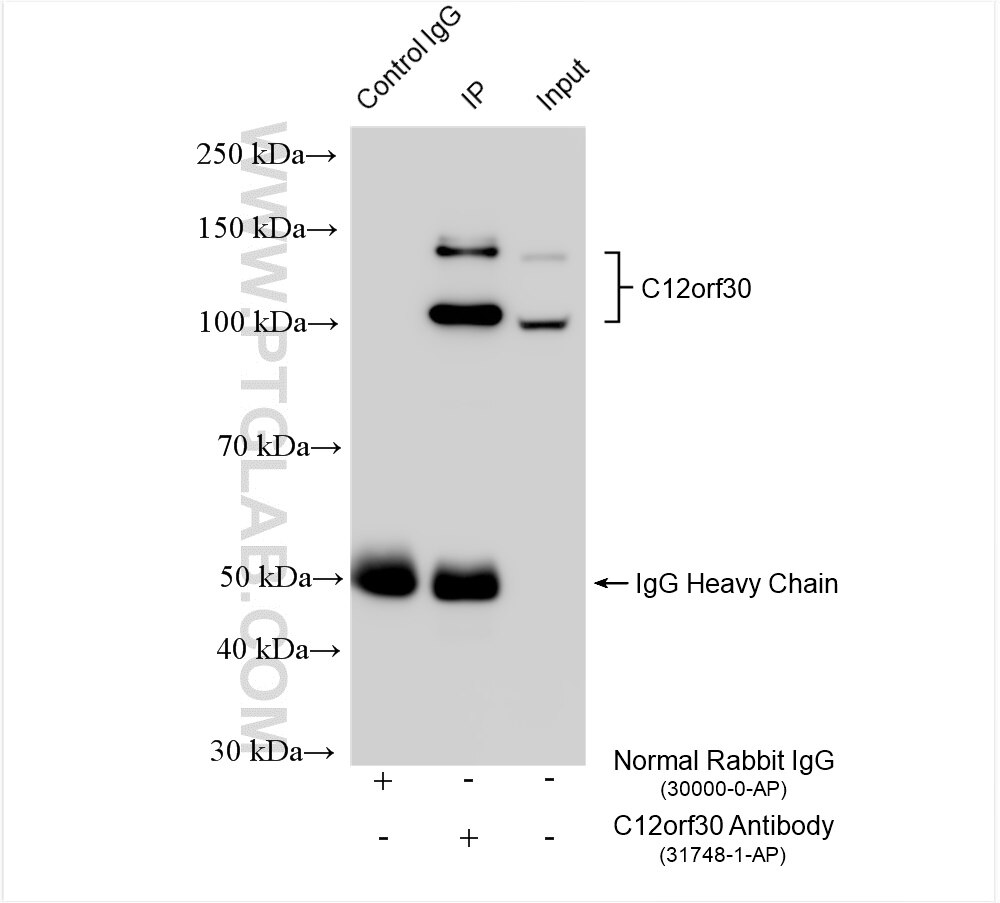 Immunoprecipitation (IP) experiment of HeLa cells using C12orf30 Polyclonal antibody (31748-1-AP)