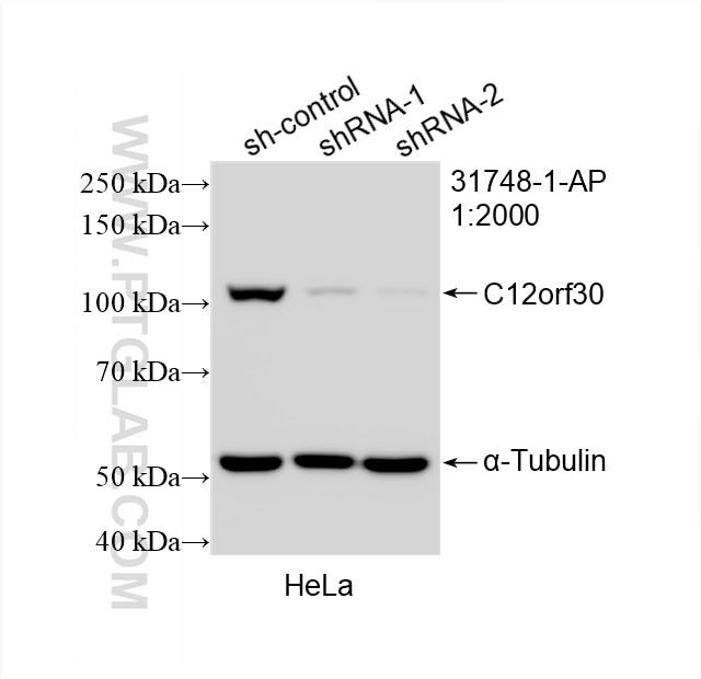 Western Blot (WB) analysis of HeLa cells using C12orf30 Polyclonal antibody (31748-1-AP)