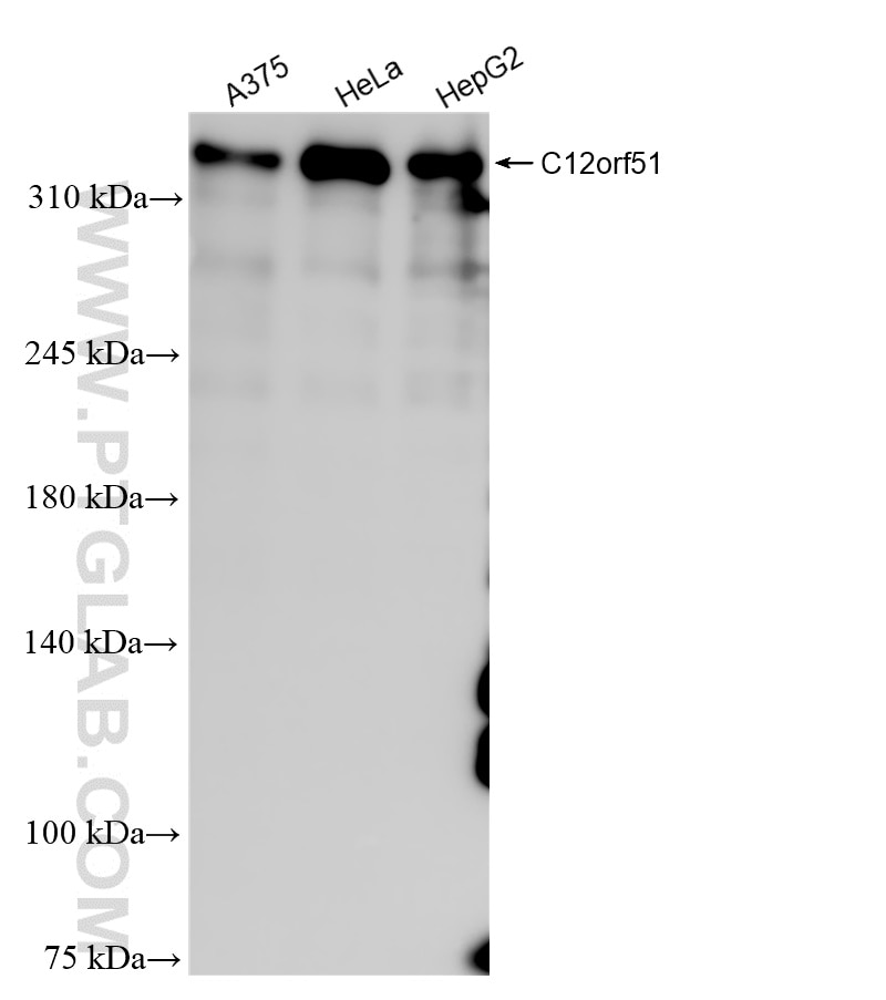 Western Blot (WB) analysis of various lysates using C12orf51 Recombinant antibody (84641-1-RR)