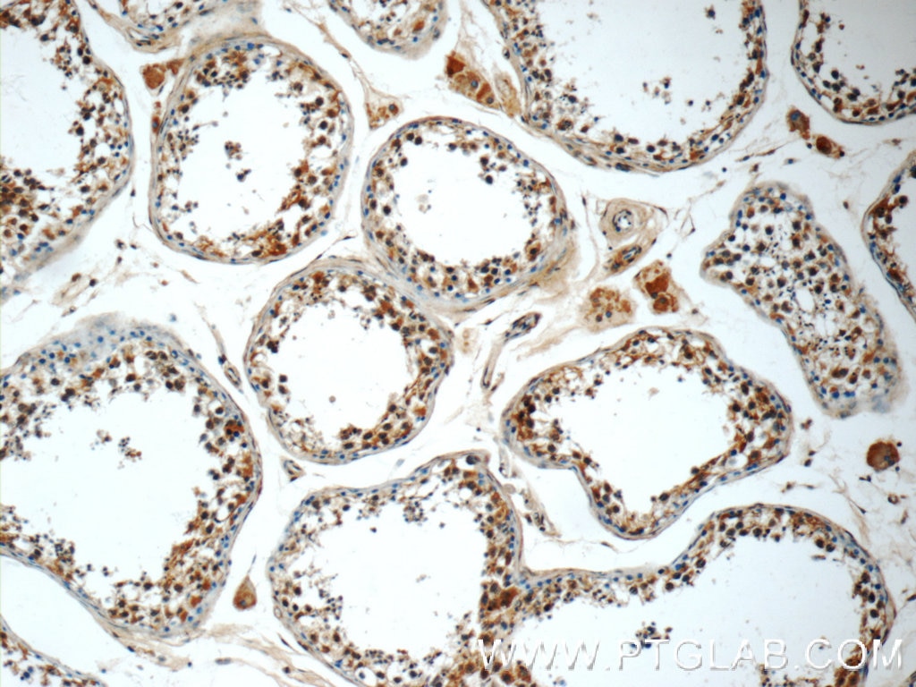 Immunohistochemistry (IHC) staining of human testis tissue using C12orf54 Polyclonal antibody (25177-1-AP)