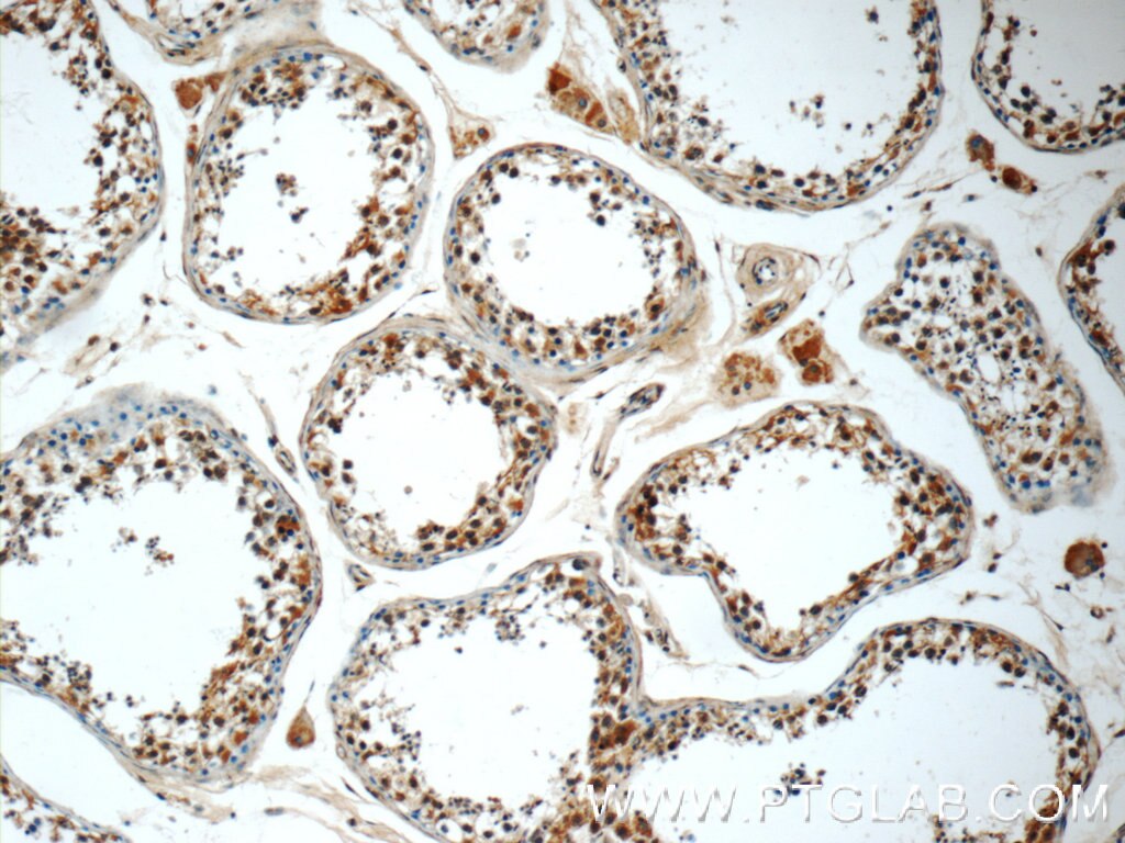 IHC staining of human testis using 25177-1-AP