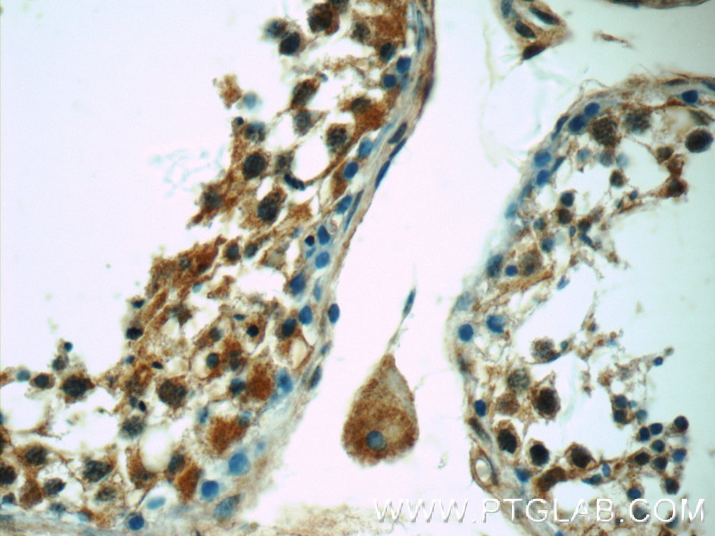 Immunohistochemistry (IHC) staining of human testis tissue using C12orf54 Polyclonal antibody (25177-1-AP)