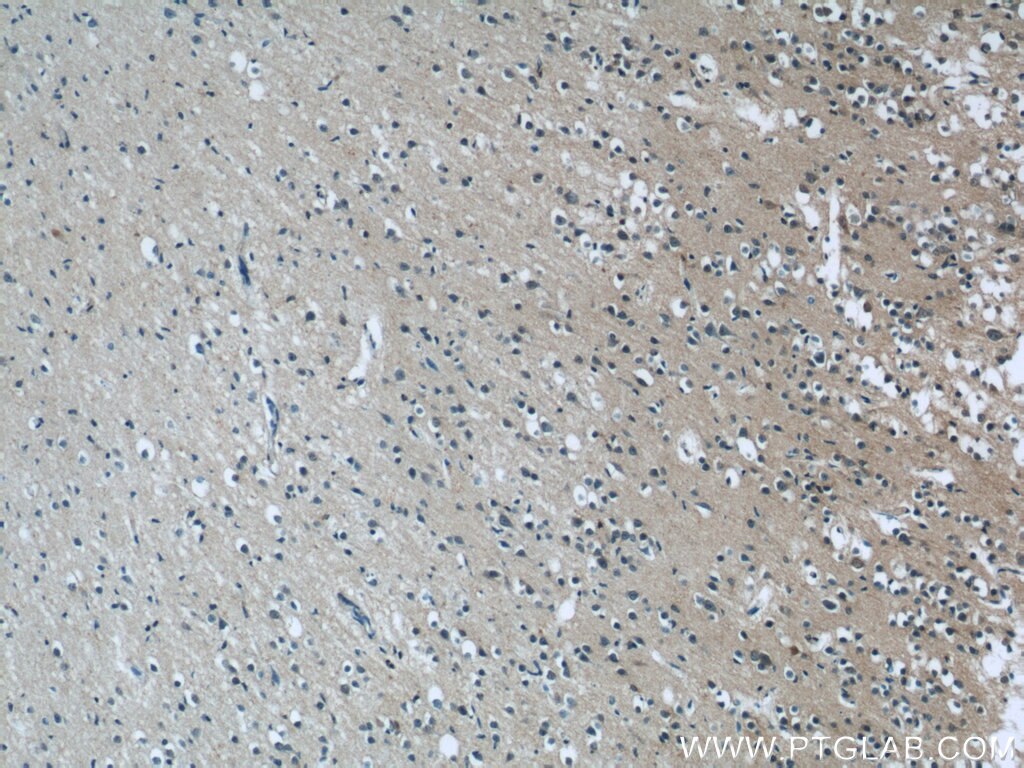 Immunohistochemistry (IHC) staining of human brain tissue using C12orf54 Polyclonal antibody (25177-1-AP)