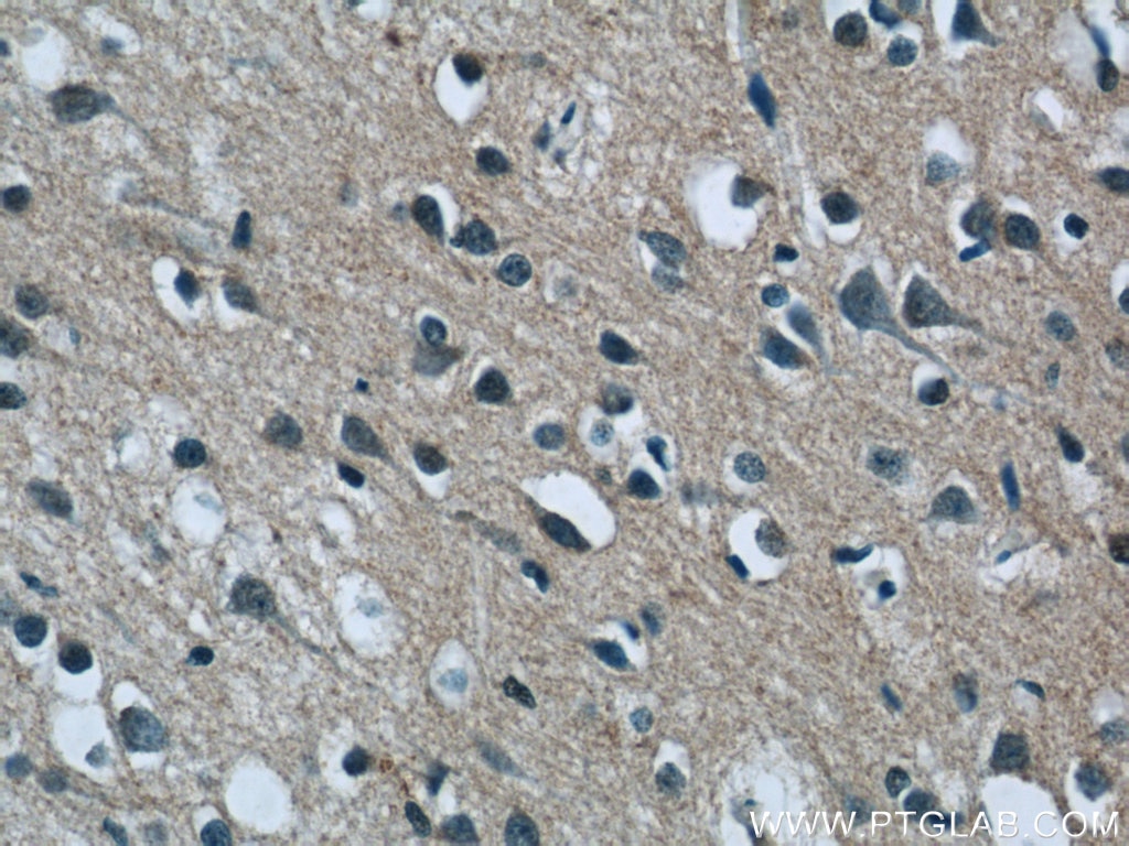 Immunohistochemistry (IHC) staining of human brain tissue using C12orf54 Polyclonal antibody (25177-1-AP)