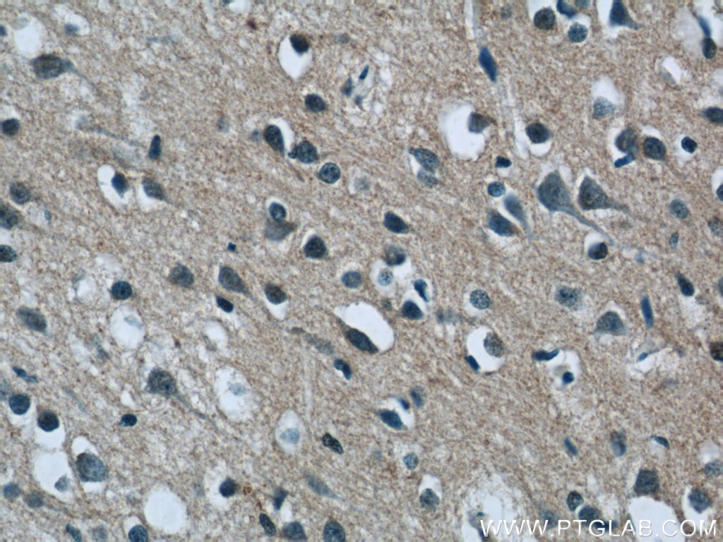 IHC staining of human brain using 25177-1-AP