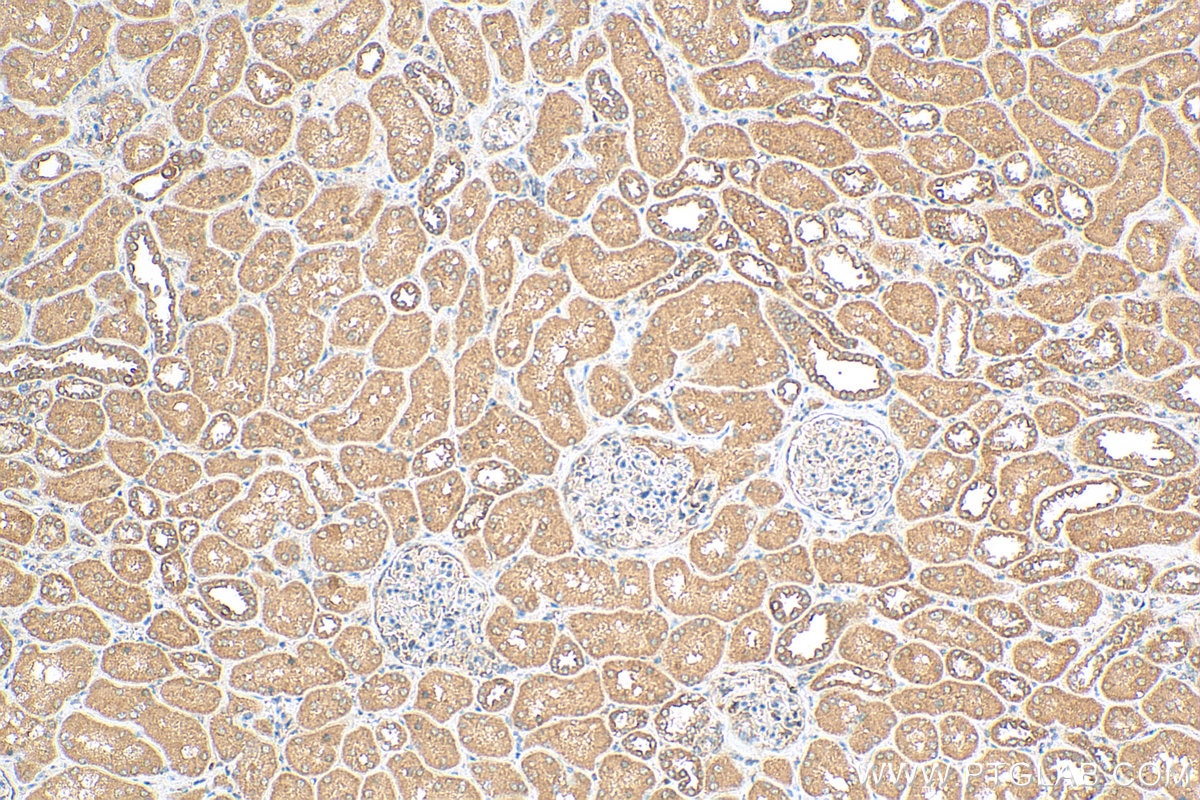 IHC staining of human kidney using 24646-1-AP