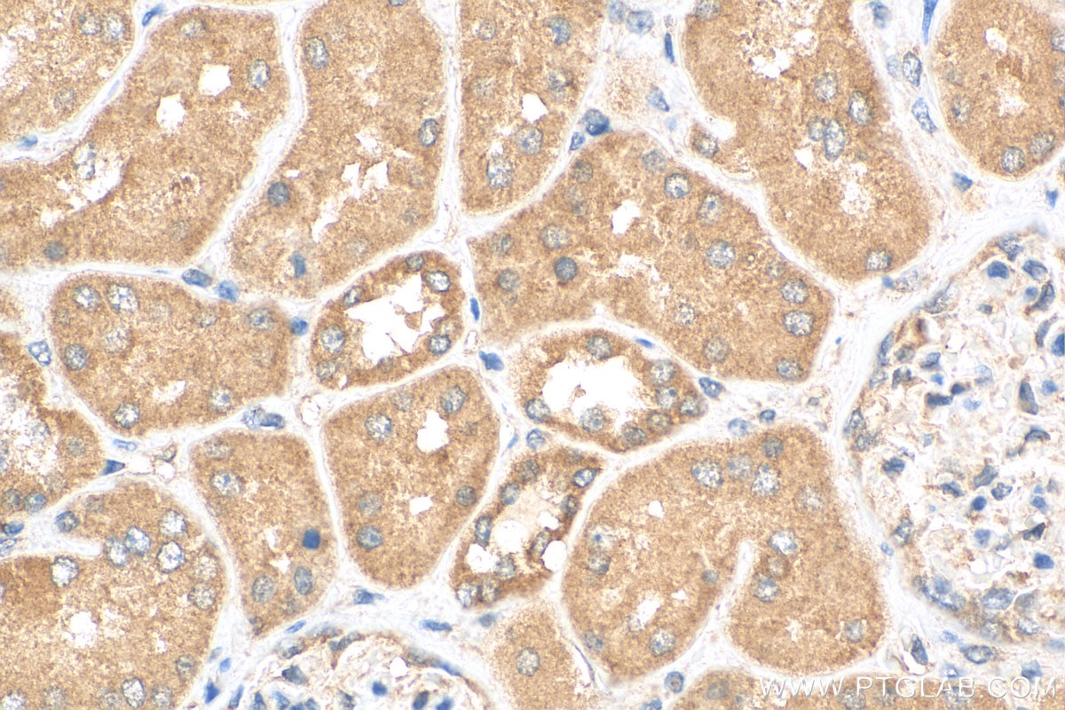 Immunohistochemistry (IHC) staining of human kidney tissue using C12orf65 Polyclonal antibody (24646-1-AP)