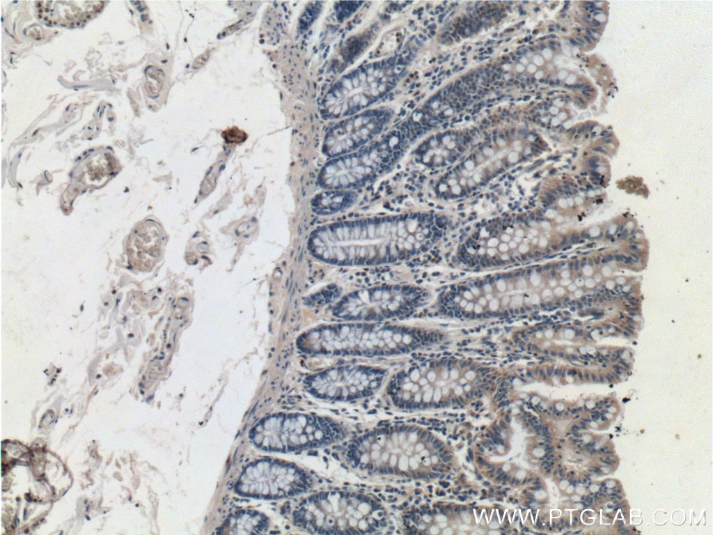 IHC staining of human colon using 26099-1-AP