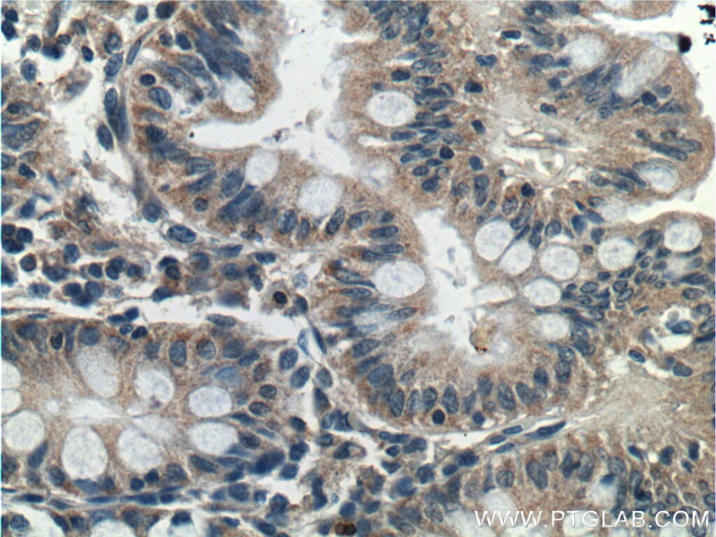 Immunohistochemistry (IHC) staining of human colon tissue using C12orf69 Polyclonal antibody (26099-1-AP)