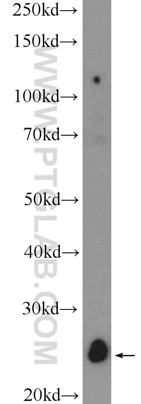 Western Blot (WB) analysis of mouse brain tissue using C12orf69 Polyclonal antibody (26099-1-AP)