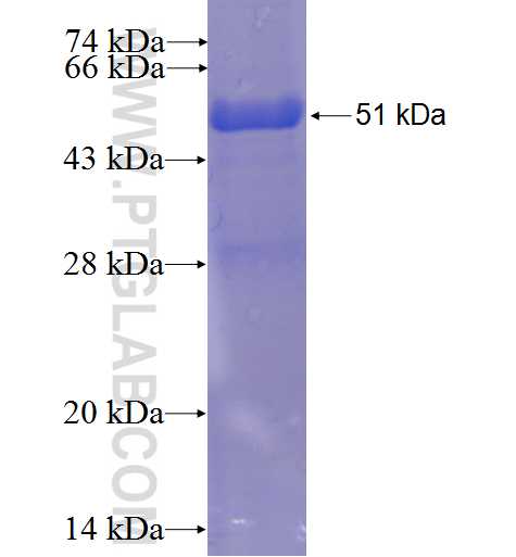 C12orf69 fusion protein Ag23419 SDS-PAGE