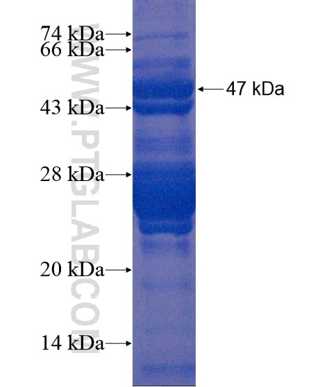 C12orf74 fusion protein Ag19538 SDS-PAGE C12orf74 fusion protein Ag19538 SDS-PAGE