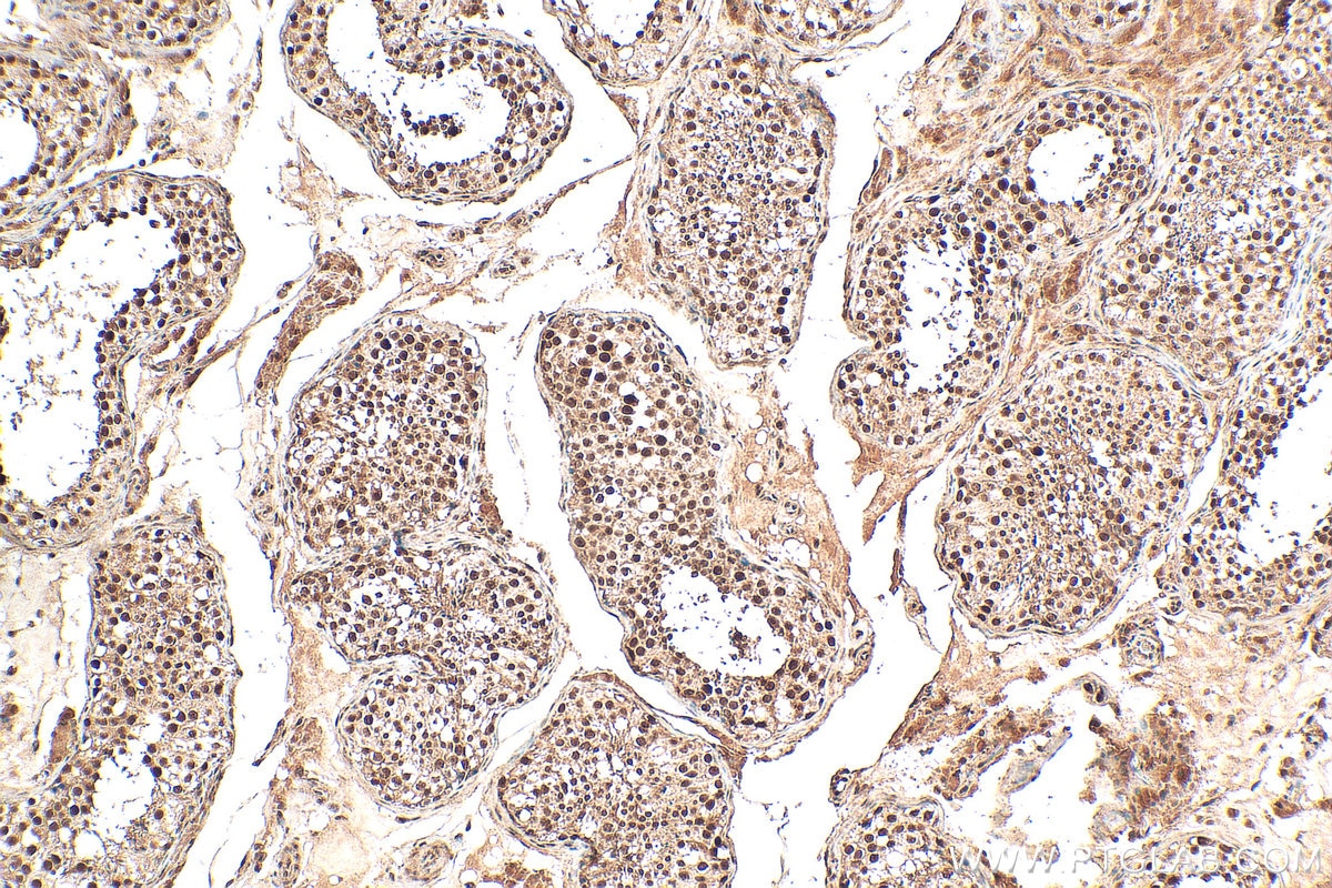 Immunohistochemistry (IHC) staining of human testis tissue using C13orf18 Polyclonal antibody (21183-1-AP)