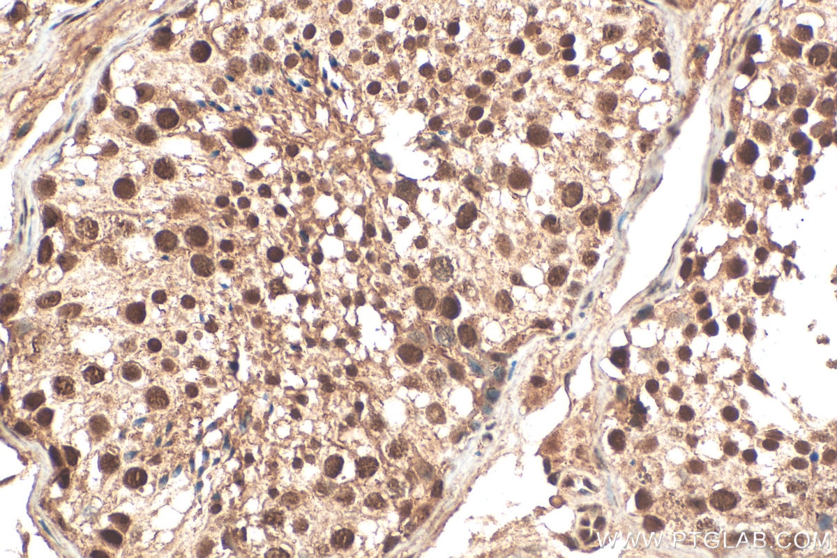 Immunohistochemistry (IHC) staining of human testis tissue using C13orf18 Polyclonal antibody (21183-1-AP)