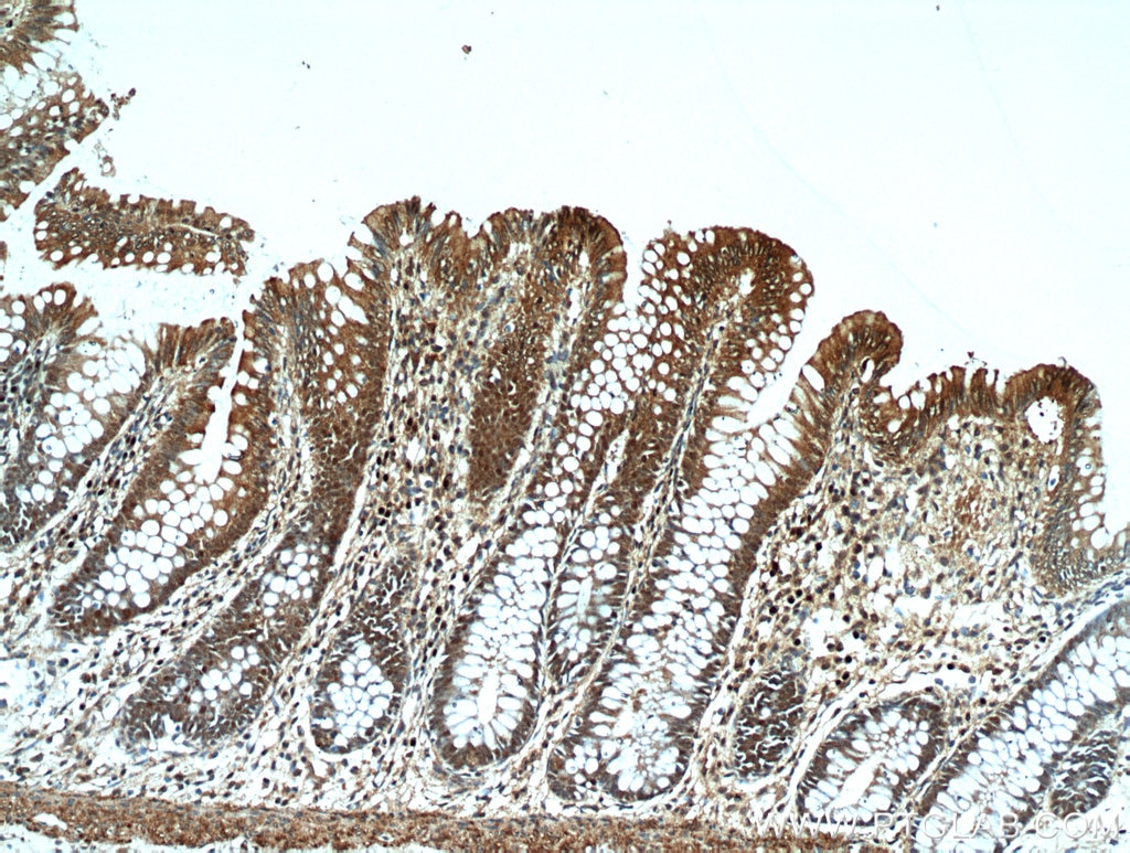 IHC staining of human colon using 21183-1-AP