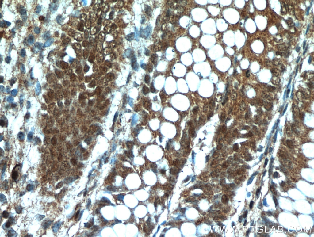 Immunohistochemistry (IHC) staining of human colon tissue using C13orf18 Polyclonal antibody (21183-1-AP)