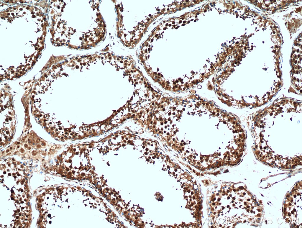 Immunohistochemistry (IHC) staining of human testis tissue using C13orf18 Polyclonal antibody (21183-1-AP)