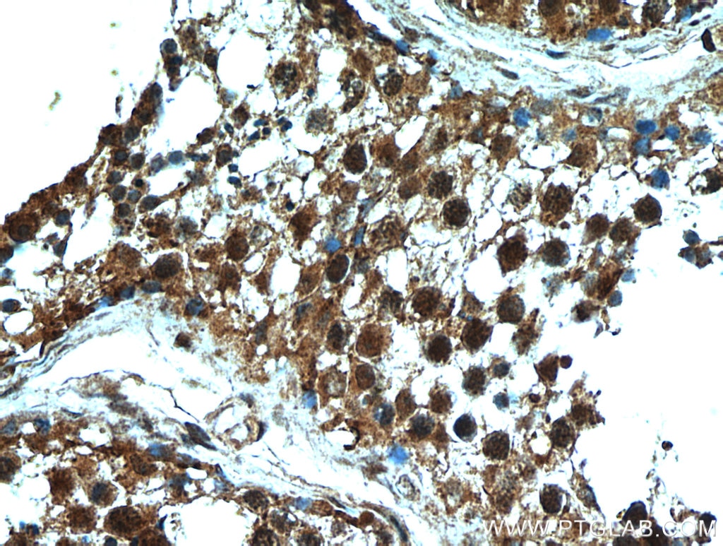 Immunohistochemistry (IHC) staining of human testis tissue using C13orf18 Polyclonal antibody (21183-1-AP)