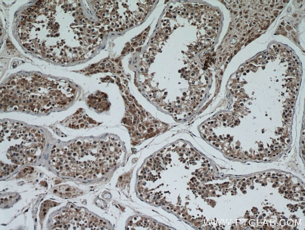 Immunohistochemistry (IHC) staining of human testis tissue using C13orf18 Polyclonal antibody (21183-1-AP)