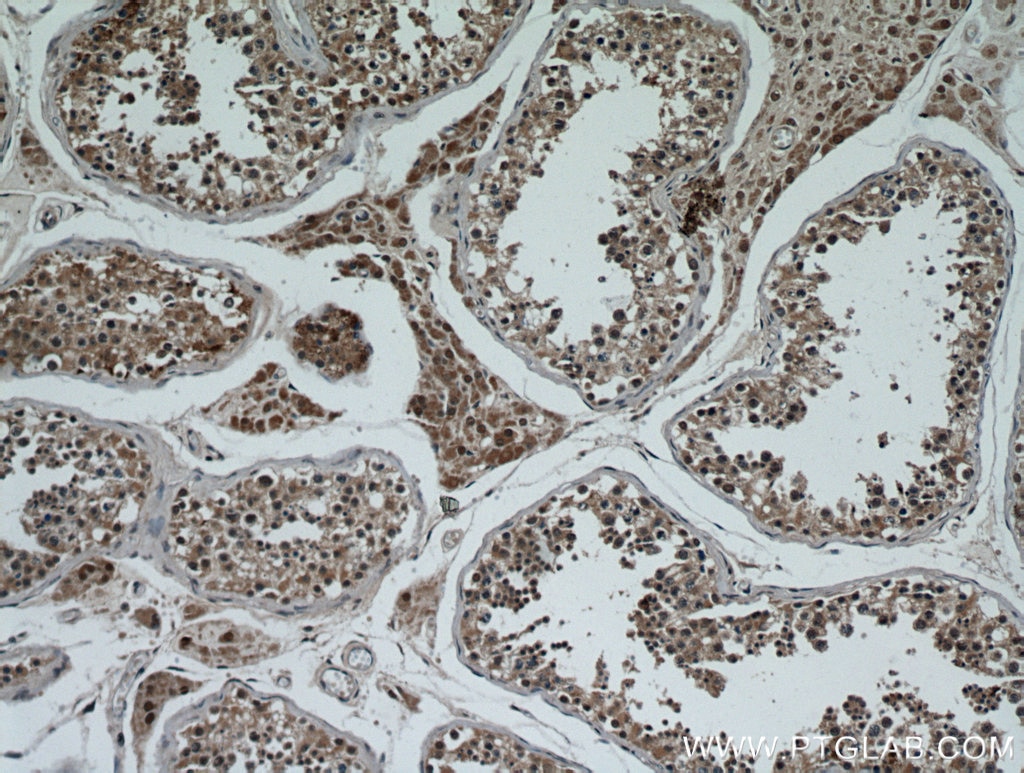 IHC staining of human testis using 21183-1-AP