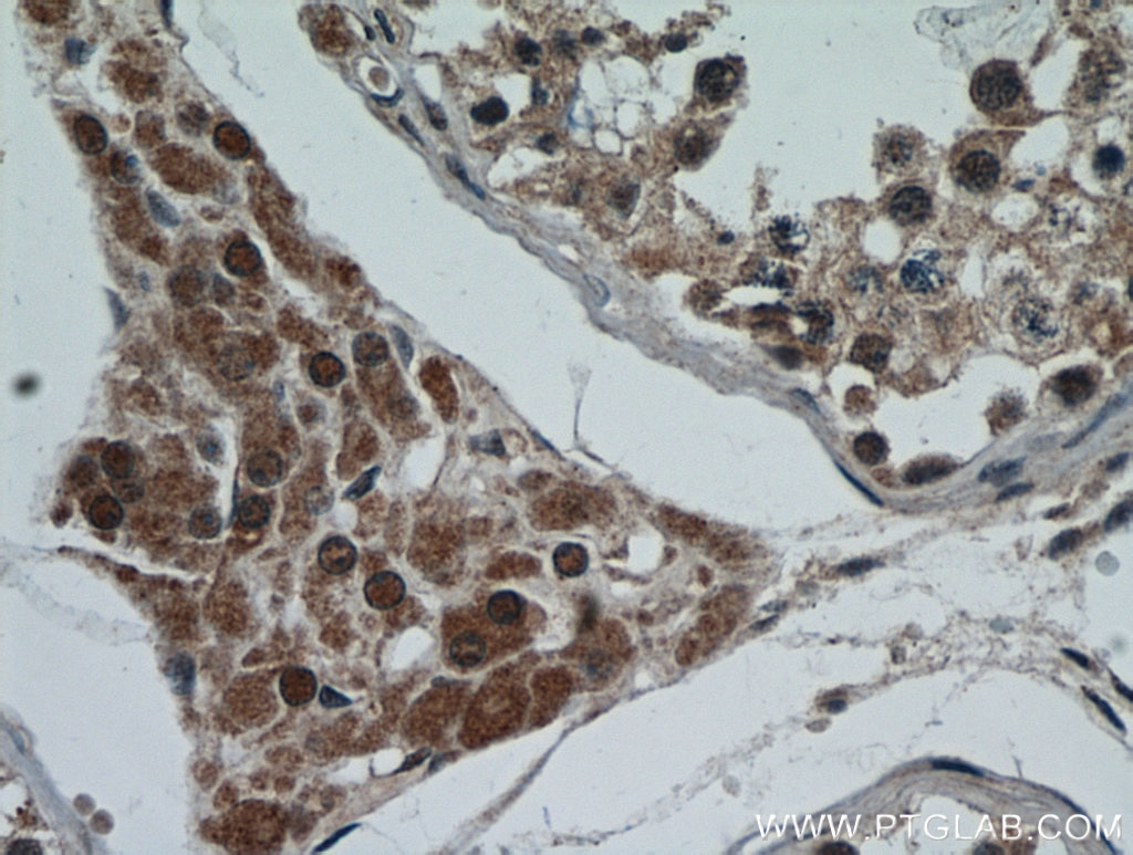 IHC staining of human testis using 21183-1-AP