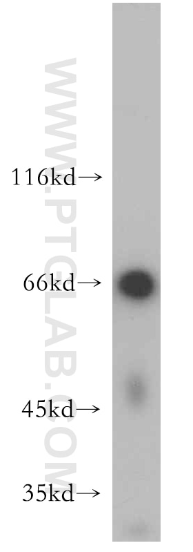 Western Blot (WB) analysis of human skeletal muscle tissue using C13orf18 Polyclonal antibody (21183-1-AP)