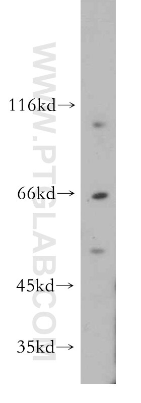 Western Blot (WB) analysis of MCF-7 cells using C13orf18 Polyclonal antibody (21183-1-AP)