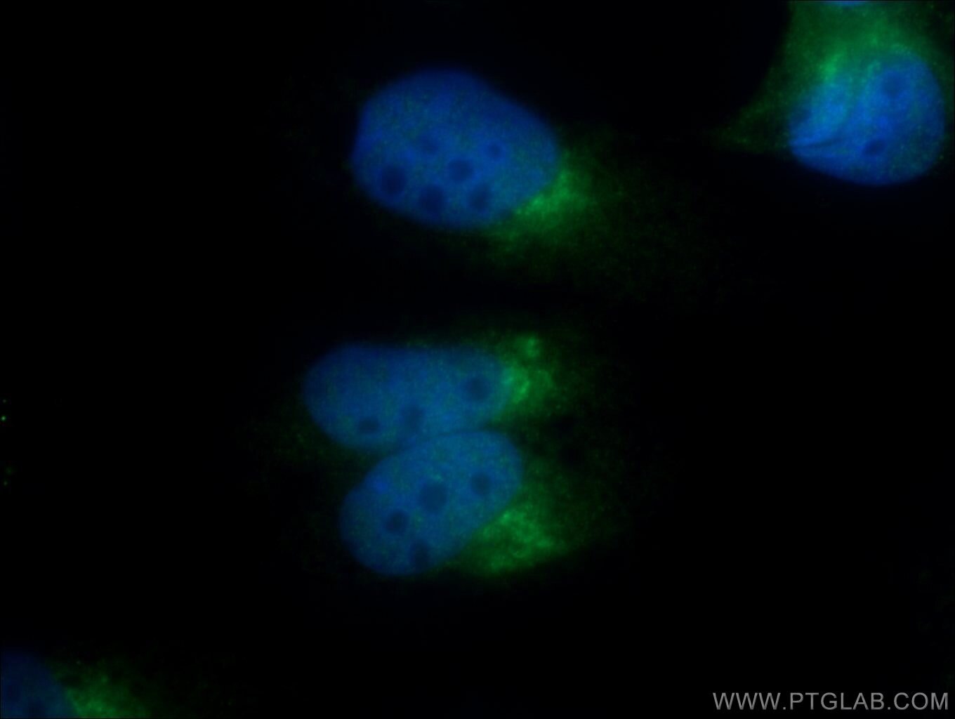 Immunofluorescence (IF) / fluorescent staining of MDCK cells using C13orf30 Polyclonal antibody (25583-1-AP)
