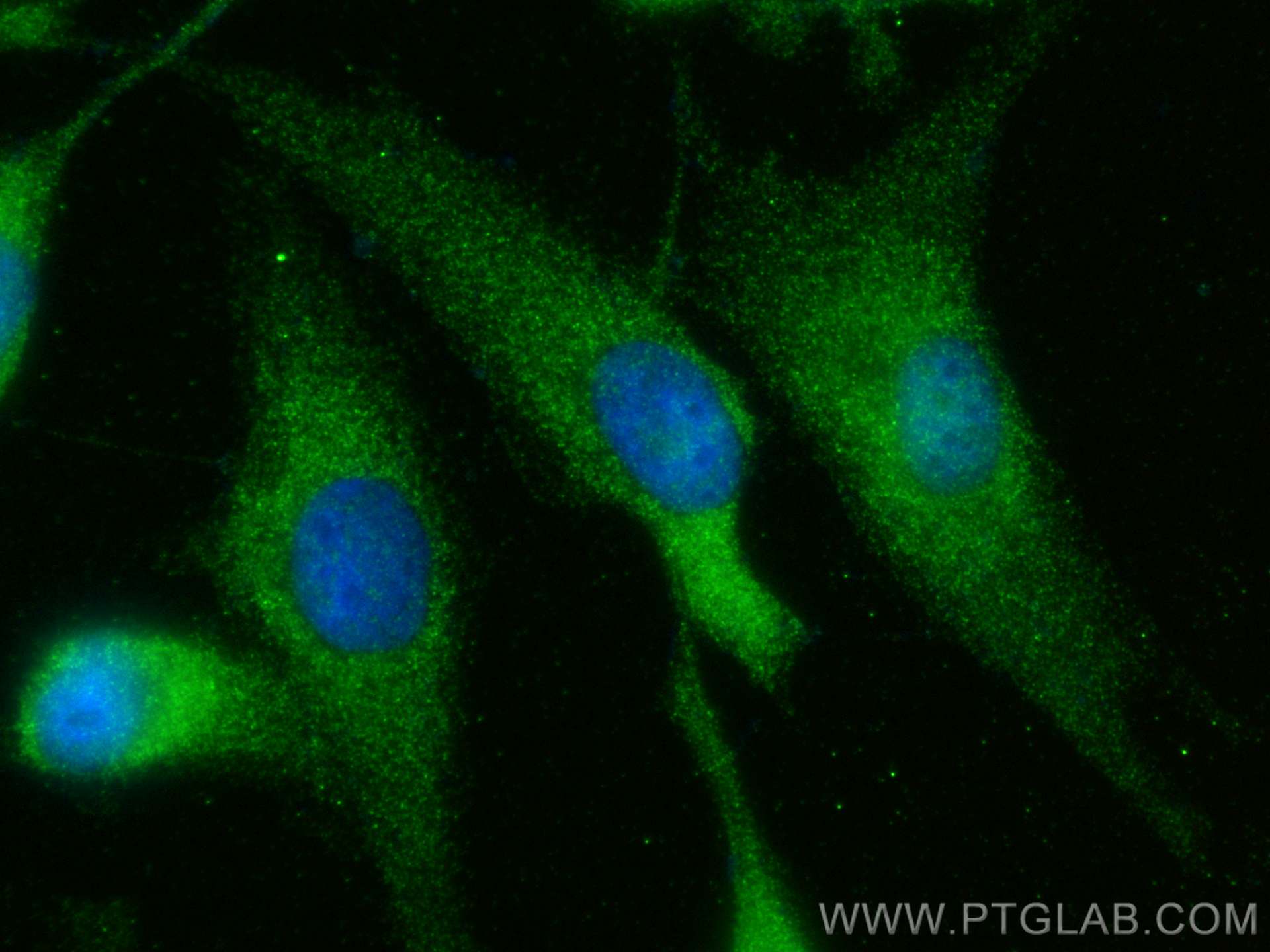 Immunofluorescence (IF) / fluorescent staining of MDCK cells using C13orf30 Polyclonal antibody (25583-1-AP)