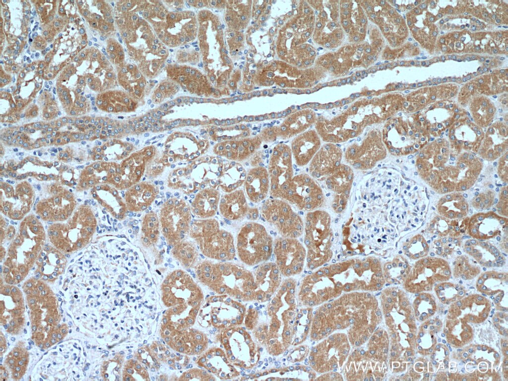 Immunohistochemistry (IHC) staining of human kidney tissue using C13orf30 Polyclonal antibody (25583-1-AP)