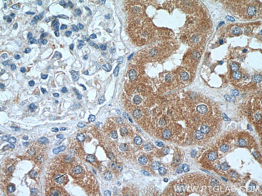 Immunohistochemistry (IHC) staining of human kidney tissue using C13orf30 Polyclonal antibody (25583-1-AP)