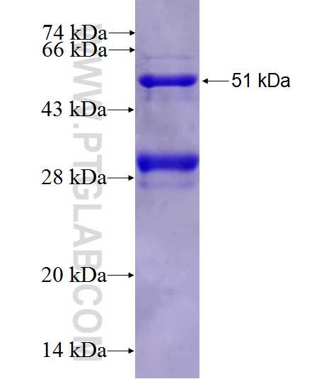 C13orf31 fusion protein Ag27308 SDS-PAGE
